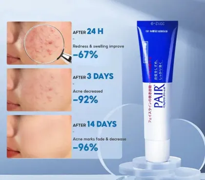 Lion Pair Acne Care 14g